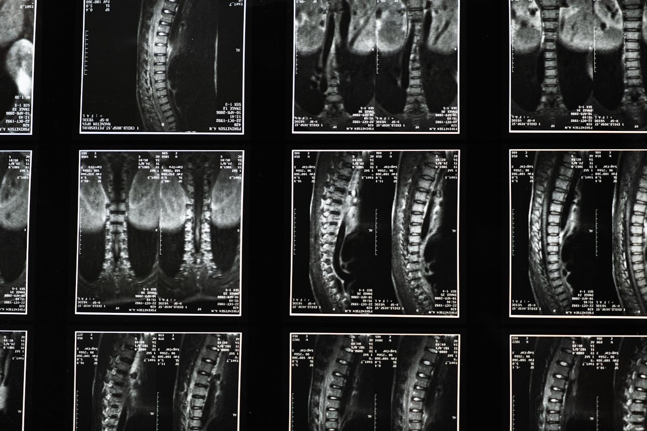 MRT-Scans zeigen mehrere Ansichten der menschlichen Wirbelsäule und des Rückenmarks, einschließlich sagittaler und koronaler Abschnitte, mit sichtbaren medizinischen Messmarkierungen – ideal für die Diagnose von Erkrankungen wie Rückenschmerzen oder Skoliose.